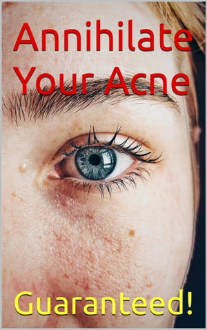 Annihilate Your Acne: How to Get Rid of Acne and Create Beautiful, Clear Skin; Your Easy, Proven Plan to Get Rid of Acne Fast