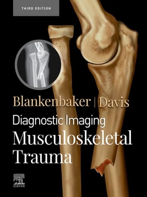 ŷKoboŻҽҥȥ㤨Diagnostic Imaging: Musculoskeletal Trauma,E-Book Diagnostic Imaging: Musculoskeletal Trauma,E-BookŻҽҡ[ Kirkland W. Davis, MD, FACR ]פβǤʤ32,574ߤˤʤޤ