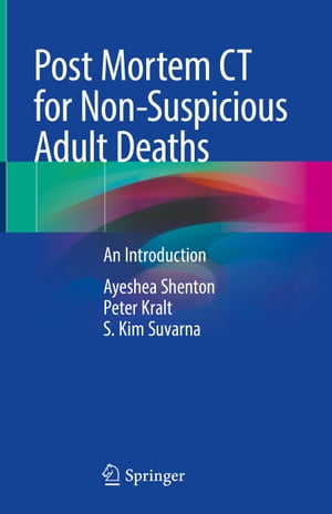 Post Mortem CT for Non-Suspicious Adult Deaths