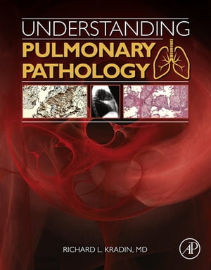 Understanding Pulmonary Pathology Applying Pathological Findings in Therapeutic Decision Making【電子書籍】 Richard L. Kradin, MD, DTM H