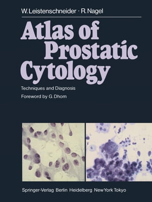 Atlas of Prostatic Cytology