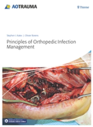 Principles of Orthopedic Infection Management