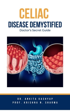 Celiac Disease Demystified: Doctor's Secret Guide