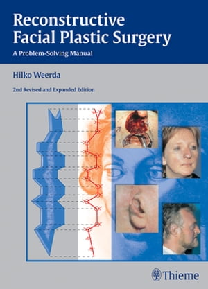 Reconstructive Facial Plastic Surgery A Problem-Solving Manual