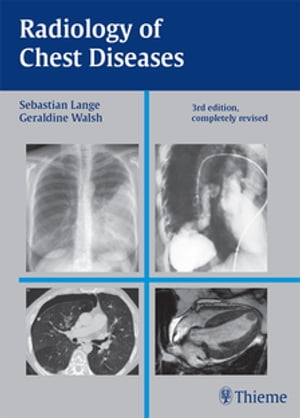 Radiology of Chest Diseases