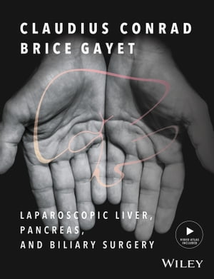 Laparoscopic Liver, Pancreas, and Biliary Surgery【電子書籍】