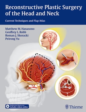 Reconstructive Plastic Surgery of the Head and Neck