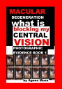 Macular Degeneration, What Is Blocking My Central Vision, Photographic Evidence Book 1【電子書籍】 Agnes Musa