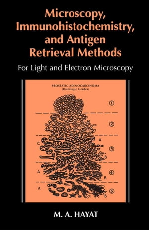 Microscopy, Immunohistochemistry, and Antigen Retrieval Methods For Light and Electron MicroscopyŻҽҡ[ M.A. Hayat ]