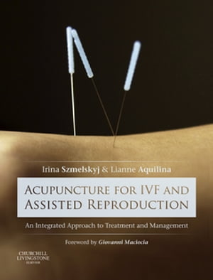 Acupuncture for IVF and Assisted Reproduction