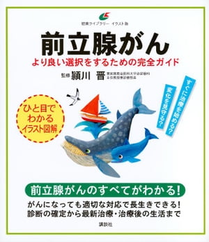 前立腺がん　より良い選択をするための完全ガイド