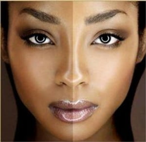 How To Get Rid of Hyperpigmentation
