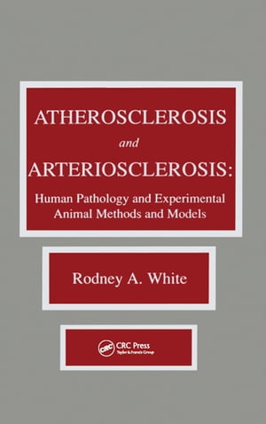 Atherosclerosis and Arteriosclerosis【電子書籍】[ Rodney A. White ]