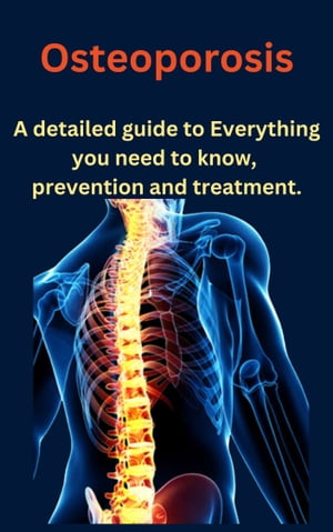 ŷKoboŻҽҥȥ㤨Osteoporosis Everything you need to know, Prevention and Treatment.Żҽҡ[ John S. Peralta ]פβǤʤ487ߤˤʤޤ