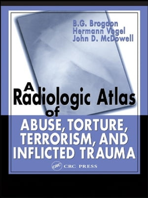 A Radiologic Atlas of Abuse, Torture, Terrorism, and Inflicted Trauma