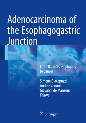 Adenocarcinoma of the Esophagogastric Junction From Barrett's Esophagus to Cancer【電子書籍】