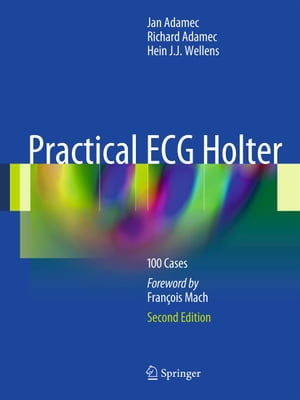 Practical ECG Holter