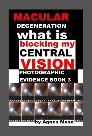 Macular Degeneration, What Is Blocking My Central Vision, Photographic Evidence Book 3