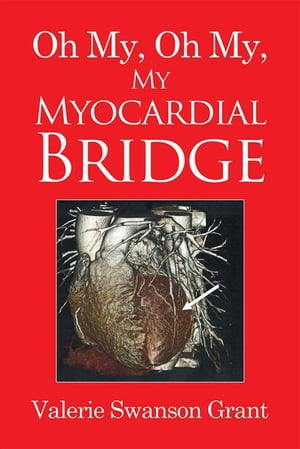 Oh My, Oh My, My Myocardial Bridge【電子書