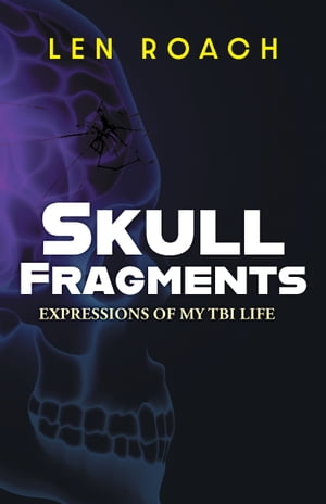 Skull Fragments