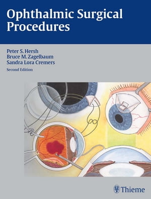 Ophthalmic Surgical Procedures