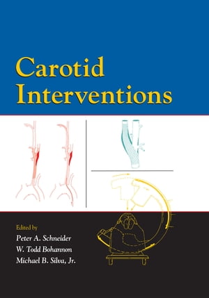 Carotid Interventions