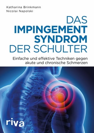 Das Impingement-Syndrom der Schulter