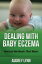 Dealing With Baby Eczema