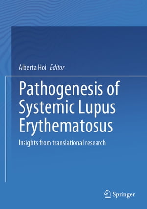 Pathogenesis of Systemic Lupus Erythematosus