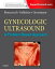 Gynecologic Ultrasound: A Problem-Based Approach E-Book