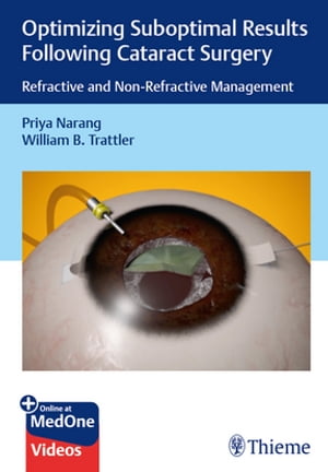 Optimizing Suboptimal Results Following Cataract Surgery