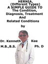 ŷKoboŻҽҥȥ㤨Hernia, (Different Types A Simple Guide To The Condition, Diagnosis, Treatment And Related ConditionsŻҽҡ[ Kenneth Kee ]פβǤʤ328ߤˤʤޤ
