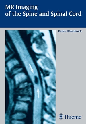 MR Imaging of the Spine and Spinal Cord