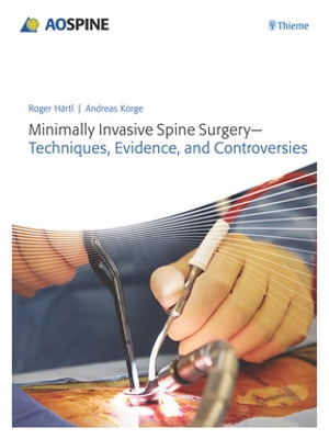 Minimally Invasive Spine Surgery - Techniques, Evidence, and Controversies