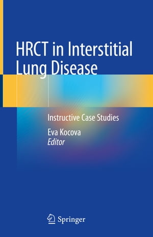 HRCT in Interstitial Lung Disease Instructive Case Studies