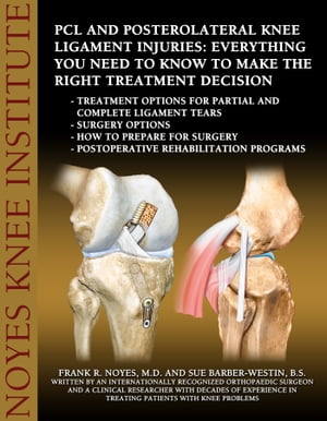 ŷKoboŻҽҥȥ㤨PCL and Posterolateral Knee Ligament Injuries: Everything You Need to Know to Make the Right Treatment Decision Treatment options for partial and complete ligament tears - surgery options - How to prepare for surgery - Postoperative rehaŻҽҡۡפβǤʤ1,301ߤˤʤޤ