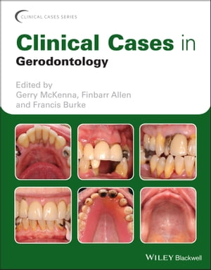 Clinical Cases in Gerodontology【電子書籍】