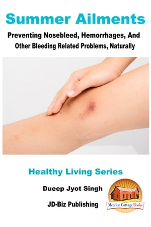 Summer Ailments: Preventing Nosebleed, Hemorrhages, And Other Bleeding Related Problems, Naturally【電子書籍】[ Dueep Jyot Singh ]
