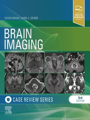 Brain Imaging: Case Review Series E-Book