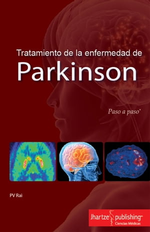TRATAMIENTO DE LA ENFERMEDAD DE PARKINSON