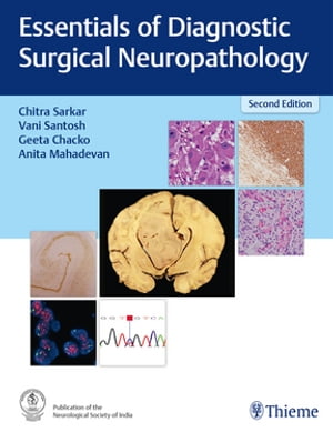ŷKoboŻҽҥȥ㤨Essentials of Diagnostic Surgical NeuropathologyŻҽҡۡפβǤʤ11,762ߤˤʤޤ