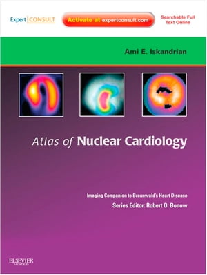 Atlas of Nuclear Cardiology: Imaging Companion to Braunwald's Heart Disease E-Book