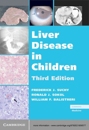 Liver Disease in Children