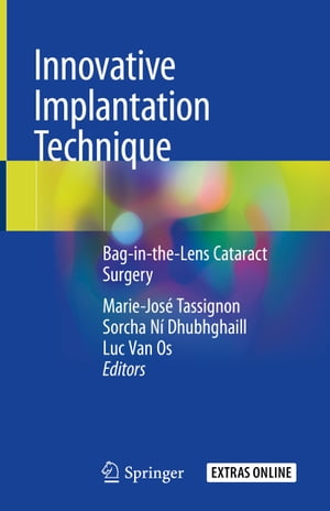 楽天楽天Kobo電子書籍ストアInnovative Implantation Technique Bag-in-the-Lens Cataract Surgery【電子書籍】
