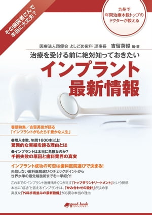 治療を受ける前に絶対知っておきたい インプラント最新情報