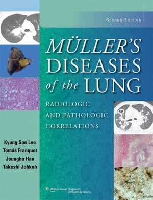 Muller's Diseases of the Lung