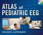 Atlas of Pediatric EEG