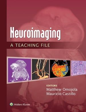 Neuroimaging: A Teaching File