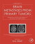 Brain Metastases from Primary Tumors, Volume 3 Epidemiology, Biology, and Therapy of Melanoma and Other CancersŻҽҡ