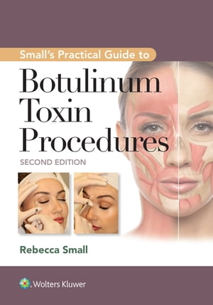 Small's Practical Guide to Botulinum Toxin Procedures【電子書籍】[ Rebecca Small ]